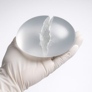 4BB75E71-94A8-49CB-A2D1-A190CB0B8EDA